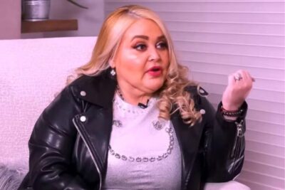 Sheyla habla respecto a la donación de su piel a niños con quemaduras graves