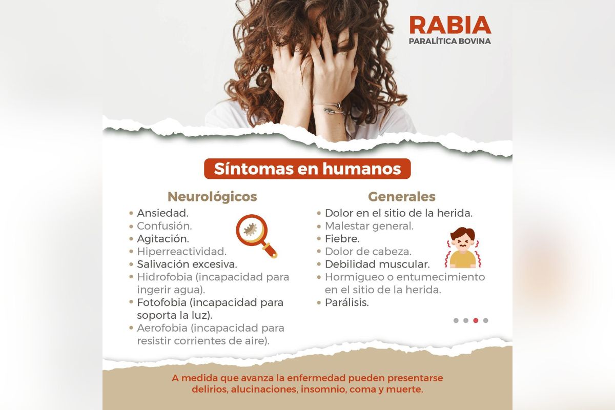 Confirma SSZ caso de rabia humana en Zacatecas.